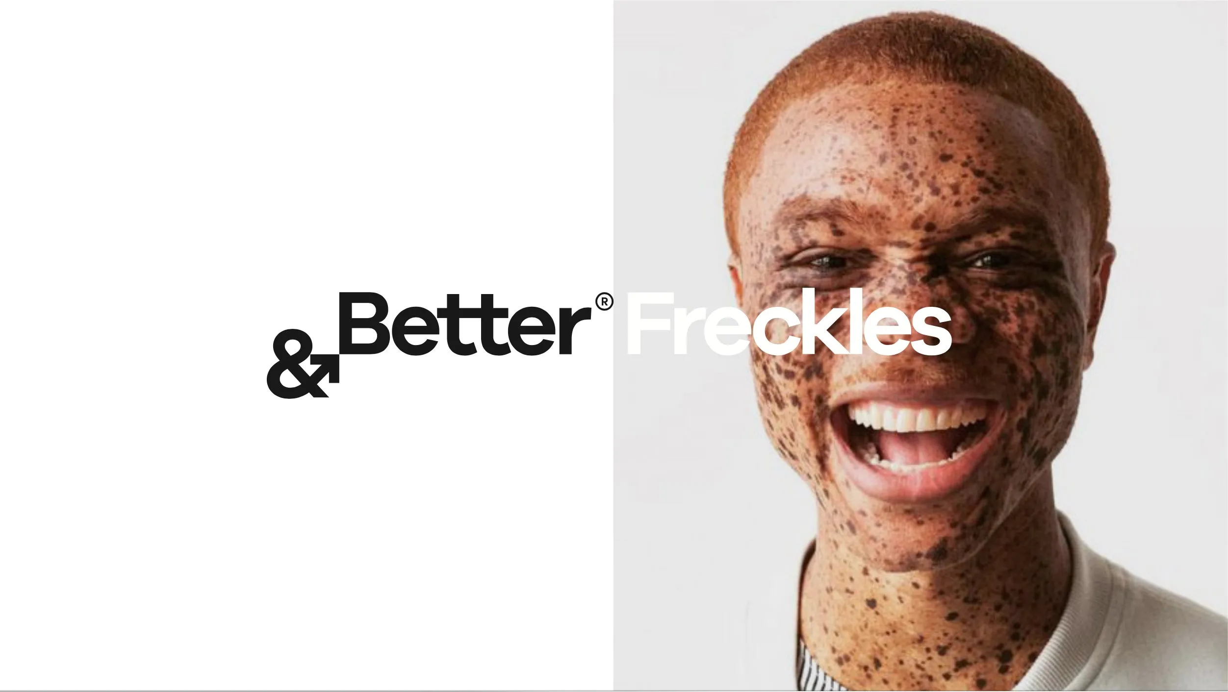 The &Better wordmark followed by the word 'Freckles', beside a portrait of a laughing freckled man in a white T-shirt.